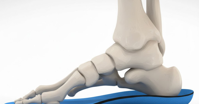 Do you have foot, knee or hip pain? Are you on your feet all day? You may need Orthotics!
